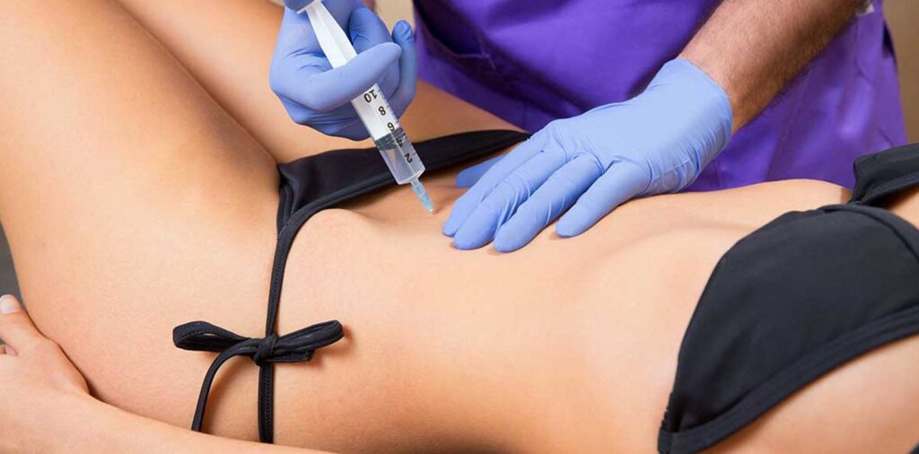 Intralipoterapia