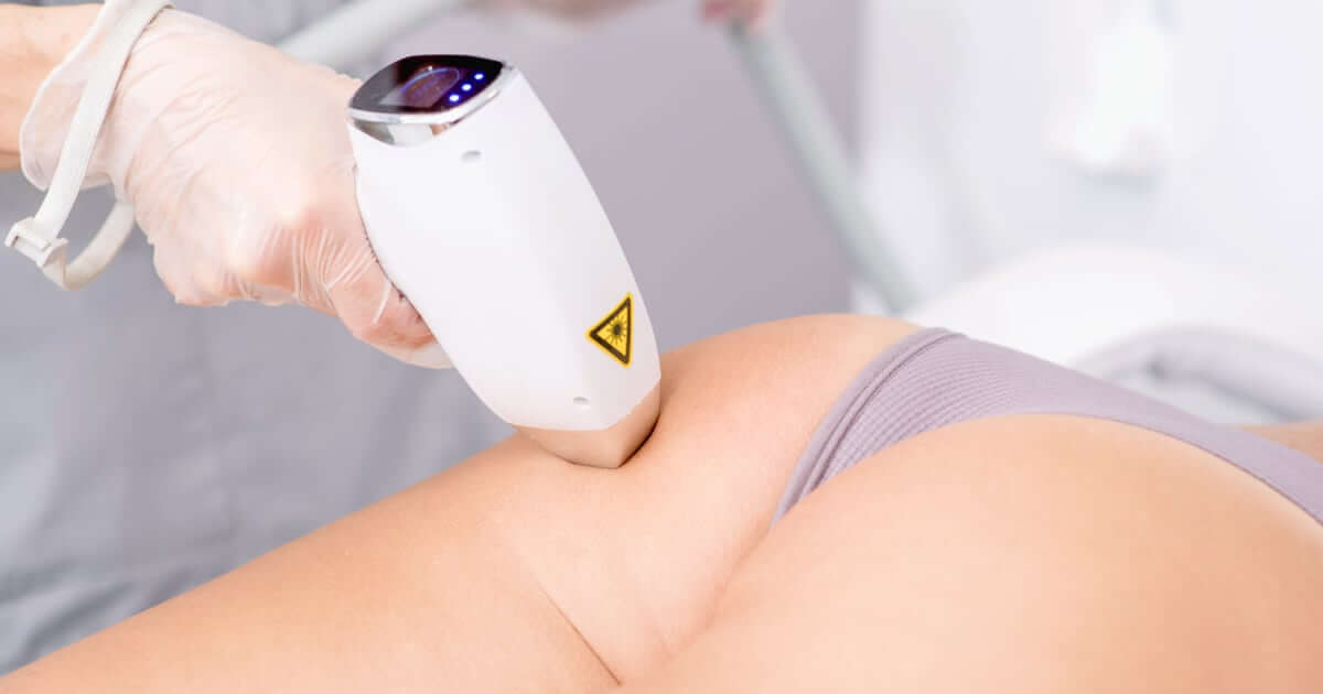 Depilación Láser Bikini con Perianal